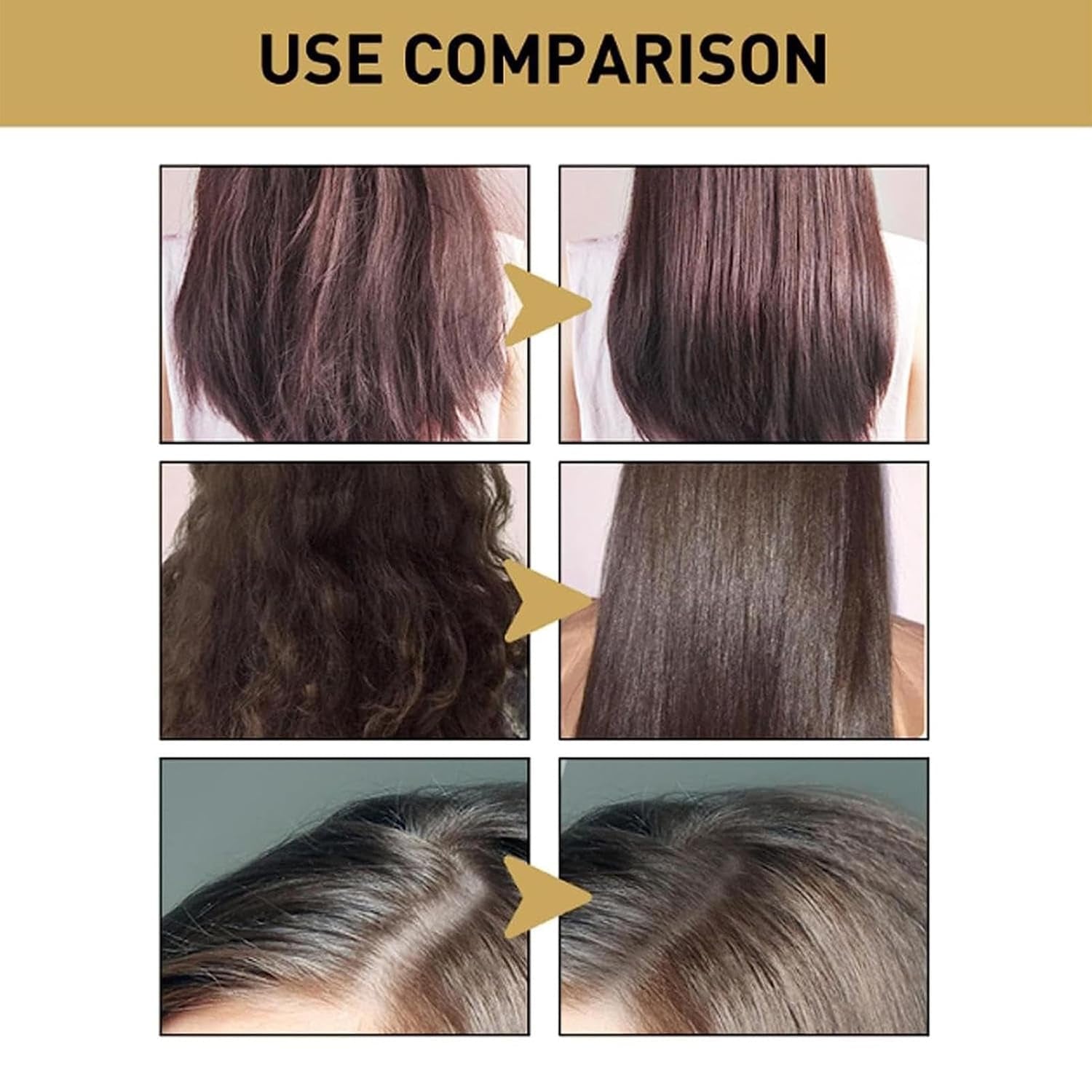 Japanisches Shampoo Und Spülung | Sakura Japanisches Shampoo Gegen Haarausfall - 300 Ml Nährendes Kopfhaut- -Shampoo, Feuchtigkeitsspendendes Reparatur- -Haarwuchs-Shampoo Für Tief Genährtes