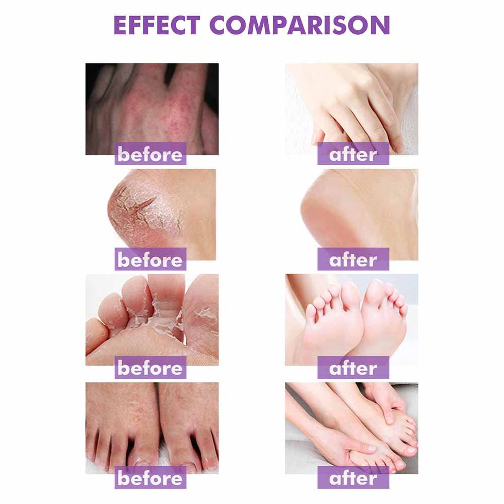 Body Cream Body Moisturizer Für Trockene Juckende Und Empfindliche Haut, Gesicht Oder Körper, Hautpflege Für Rötungen Und Trockenheit