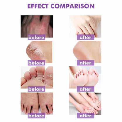 Body Cream Body Moisturizer Für Trockene Juckende Und Empfindliche Haut, Gesicht Oder Körper, Hautpflege Für Rötungen Und Trockenheit