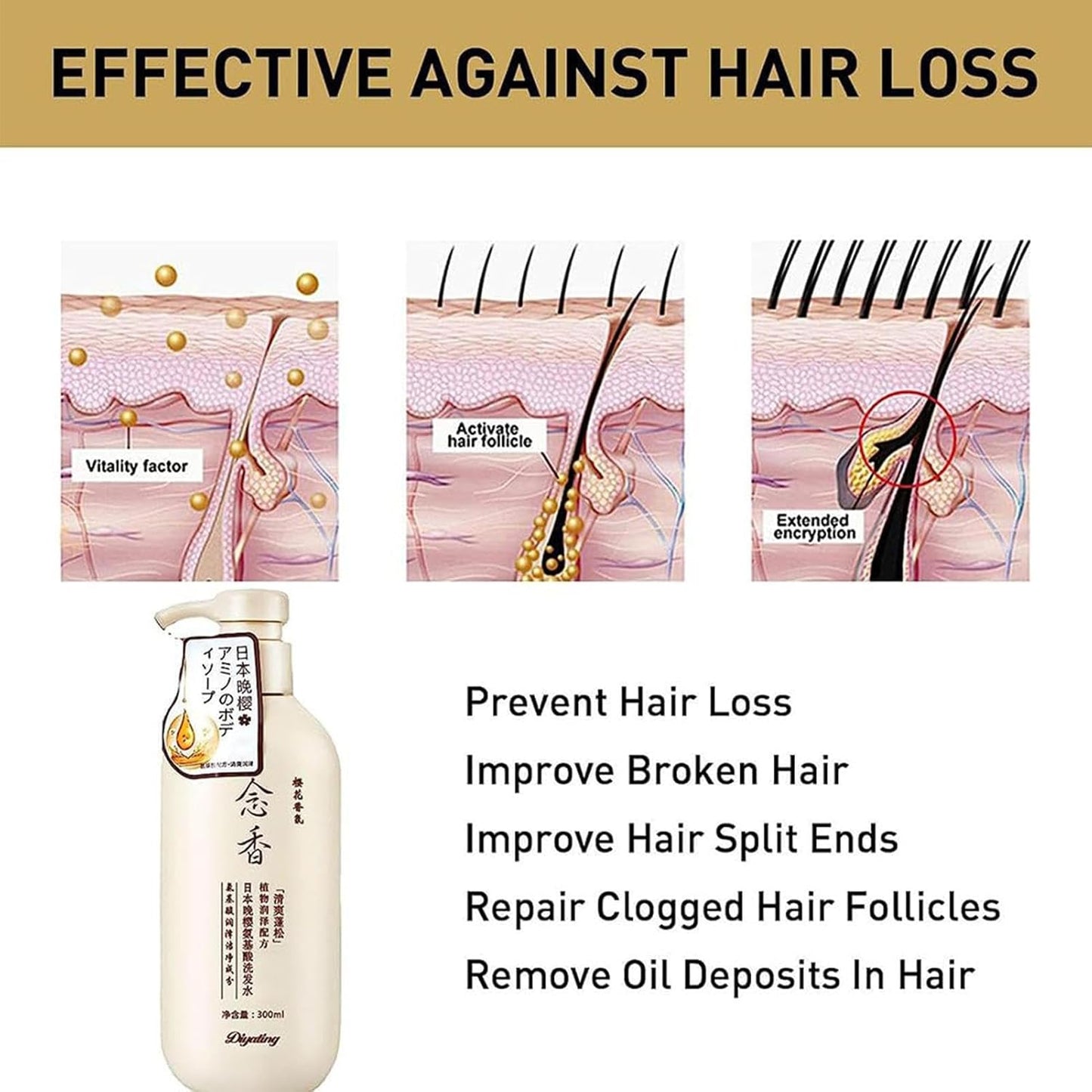 Japanisches Shampoo Und Spülung | Sakura Japanisches Shampoo Gegen Haarausfall - 300 Ml Nährendes Kopfhaut- -Shampoo, Feuchtigkeitsspendendes Reparatur- -Haarwuchs-Shampoo Für Tief Genährtes