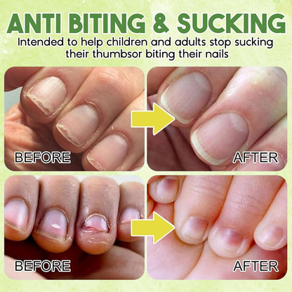 Anti Nagelkauen Nagellack,Nagellack Gegen Nägelkauen,(10Ml) Bitter Nail Nagellack,Nagel Kau-Stop Für Kinder & Erwachsene,Effektives Mittel Zum Stoppen Von Fingernägel Kauen