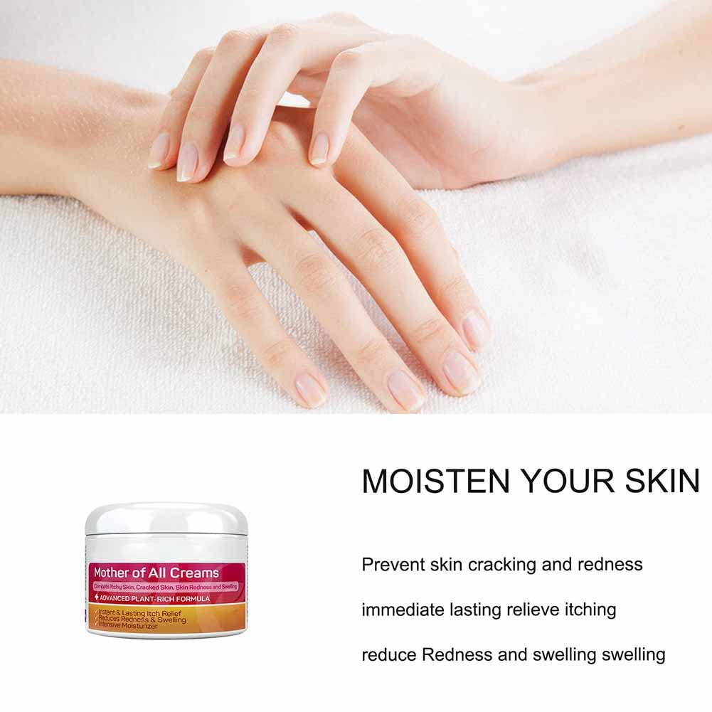 Body Cream Body Moisturizer Für Trockene Juckende Und Empfindliche Haut, Gesicht Oder Körper, Hautpflege Für Rötungen Und Trockenheit